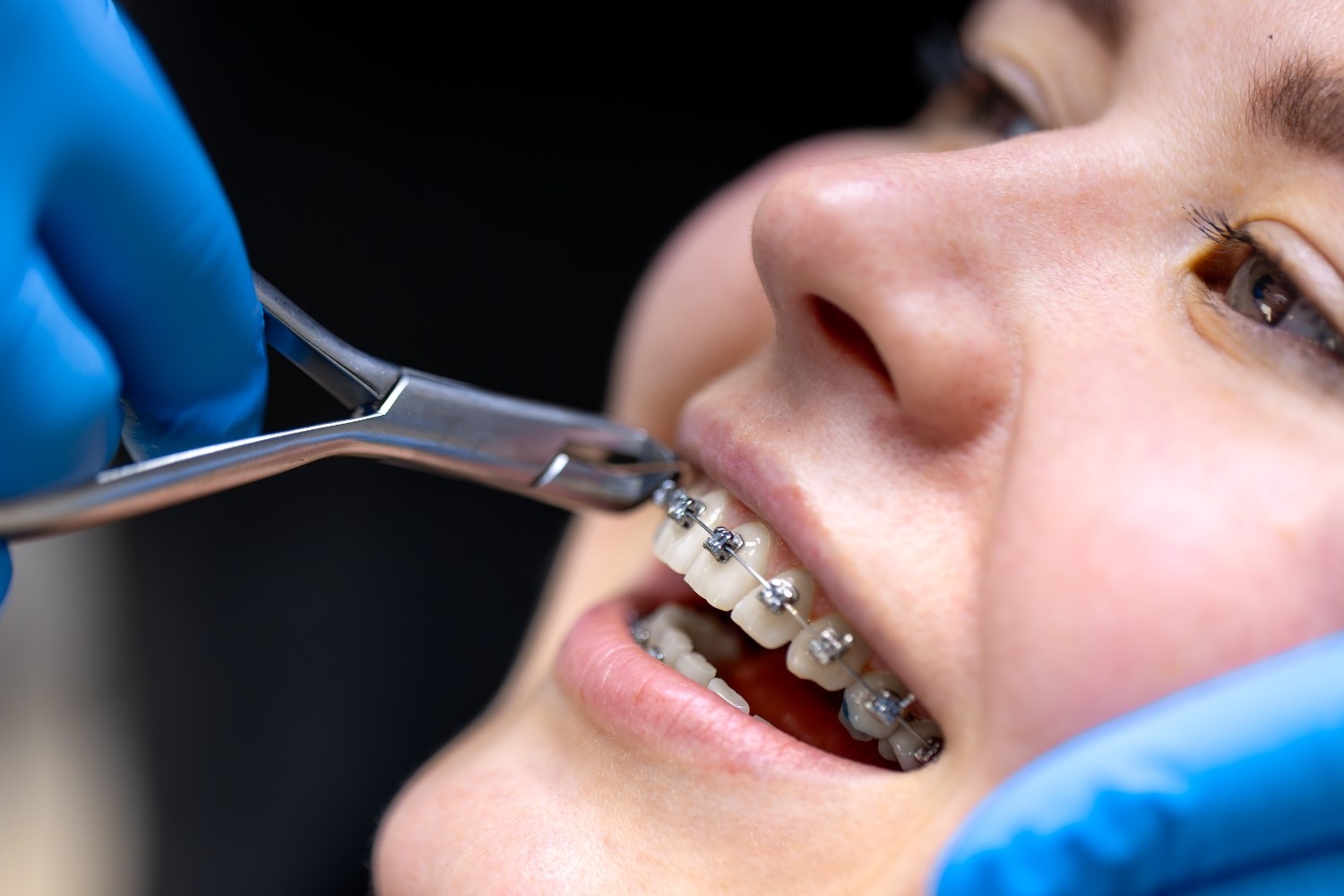 Orthodontic AR Management